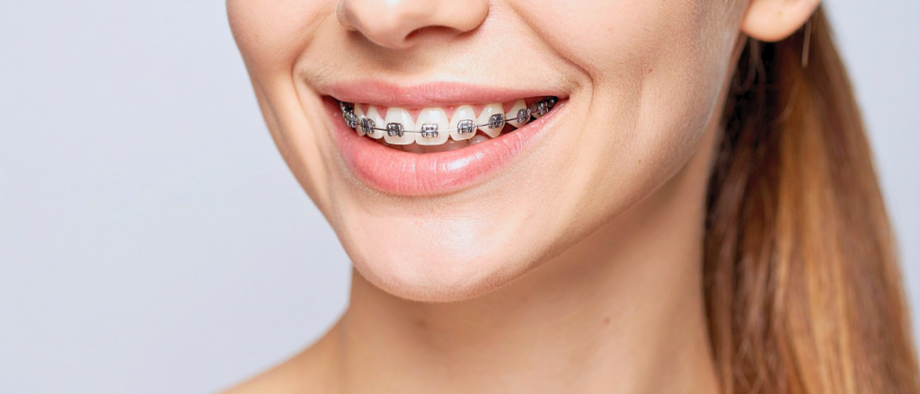 hilo-dental-ortodoncia